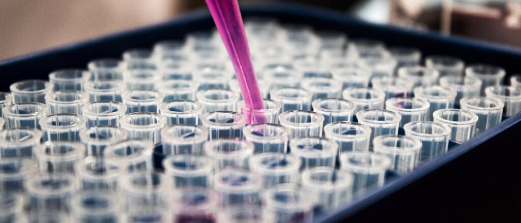 Laboratoriumonderzoek met pipet